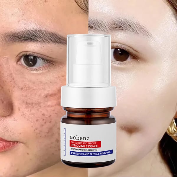 NO.1 MELASMA TREATMENT SERUM