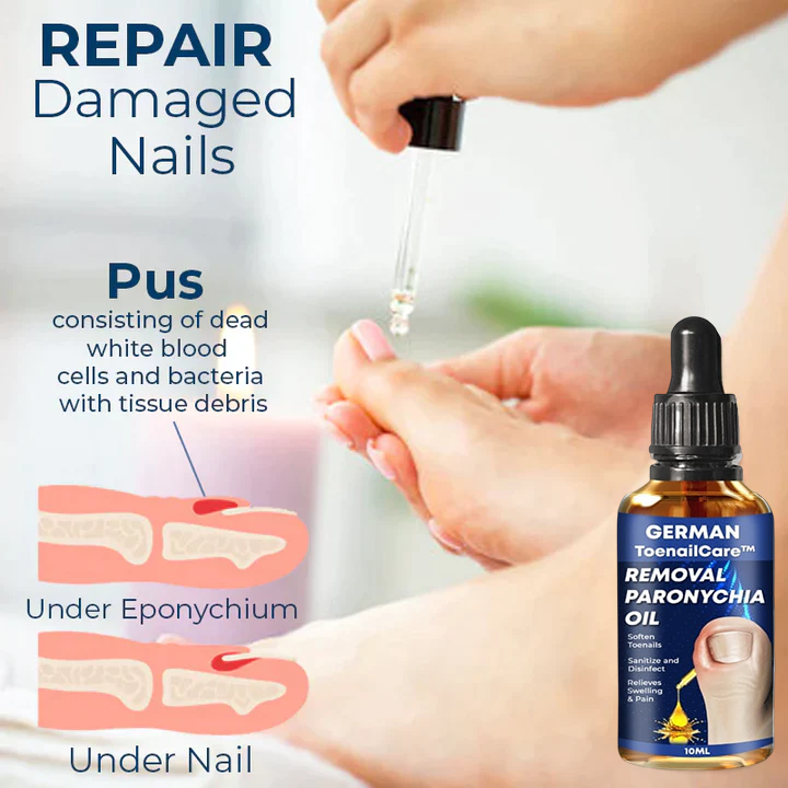 German ToenailCare™ Removal Paronychia Oil - Nuskin Beauty Store