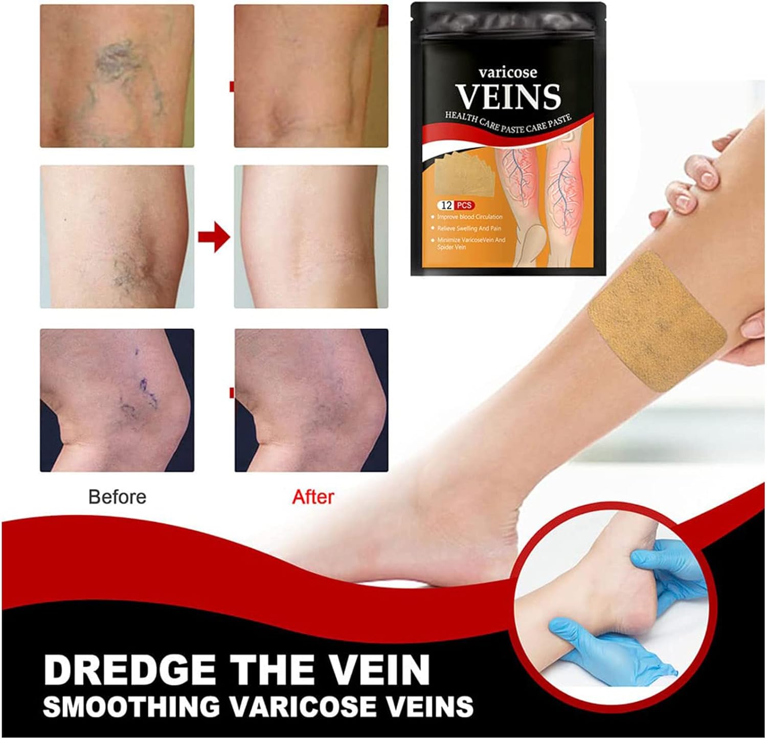 [SALE 30%] ™Vein Care Patch™ - Nuskin Beauty Store