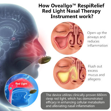 Oveallgo™ RespiRelief Red Light Nasal Therapy Instrument - Nuskin Beauty Store