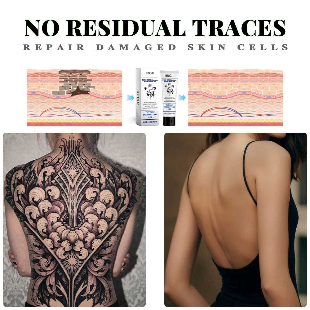 Tattoo Removal Cream: Fast, Painless & Scar-Free Tattoo Erasure - Nuskin Beauty Store