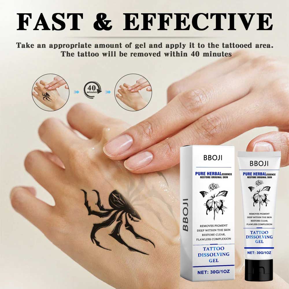 Tattoo Removal Cream: Fast, Painless & Scar-Free Tattoo Erasure - Nuskin Beauty Store