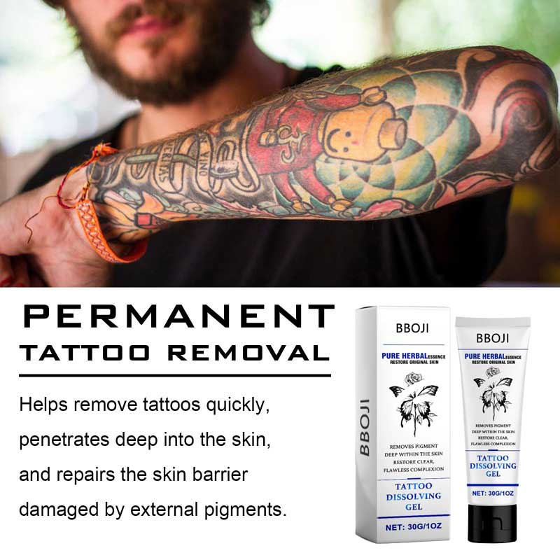 Tattoo Removal Cream: Fast, Painless & Scar-Free Tattoo Erasure - Nuskin Beauty Store