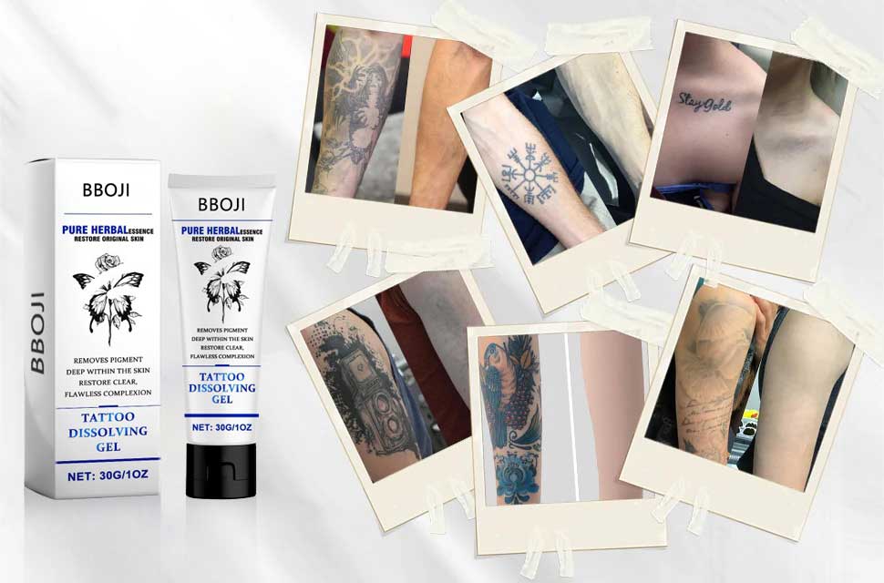 Tattoo Removal Cream: Fast, Painless & Scar-Free Tattoo Erasure - Nuskin Beauty Store