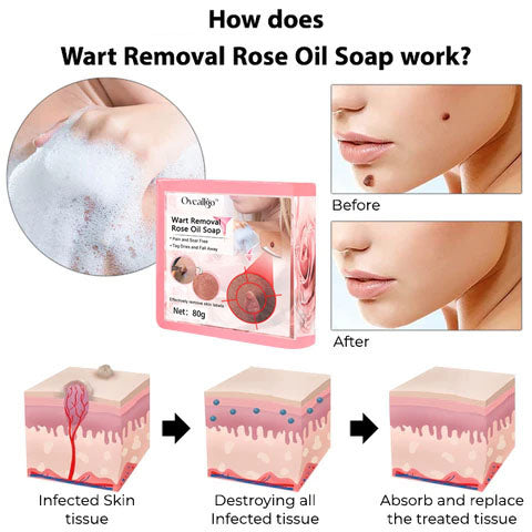 CC™ Wart Removal Rose Oil Soap - Nuskin Beauty Store