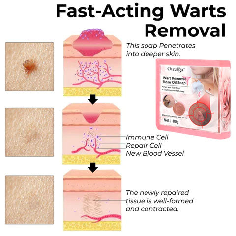 CC™ Wart Removal Rose Oil Soap - Nuskin Beauty Store