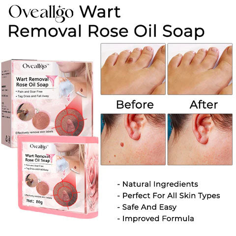 CC™ Wart Removal Rose Oil Soap - Nuskin Beauty Store