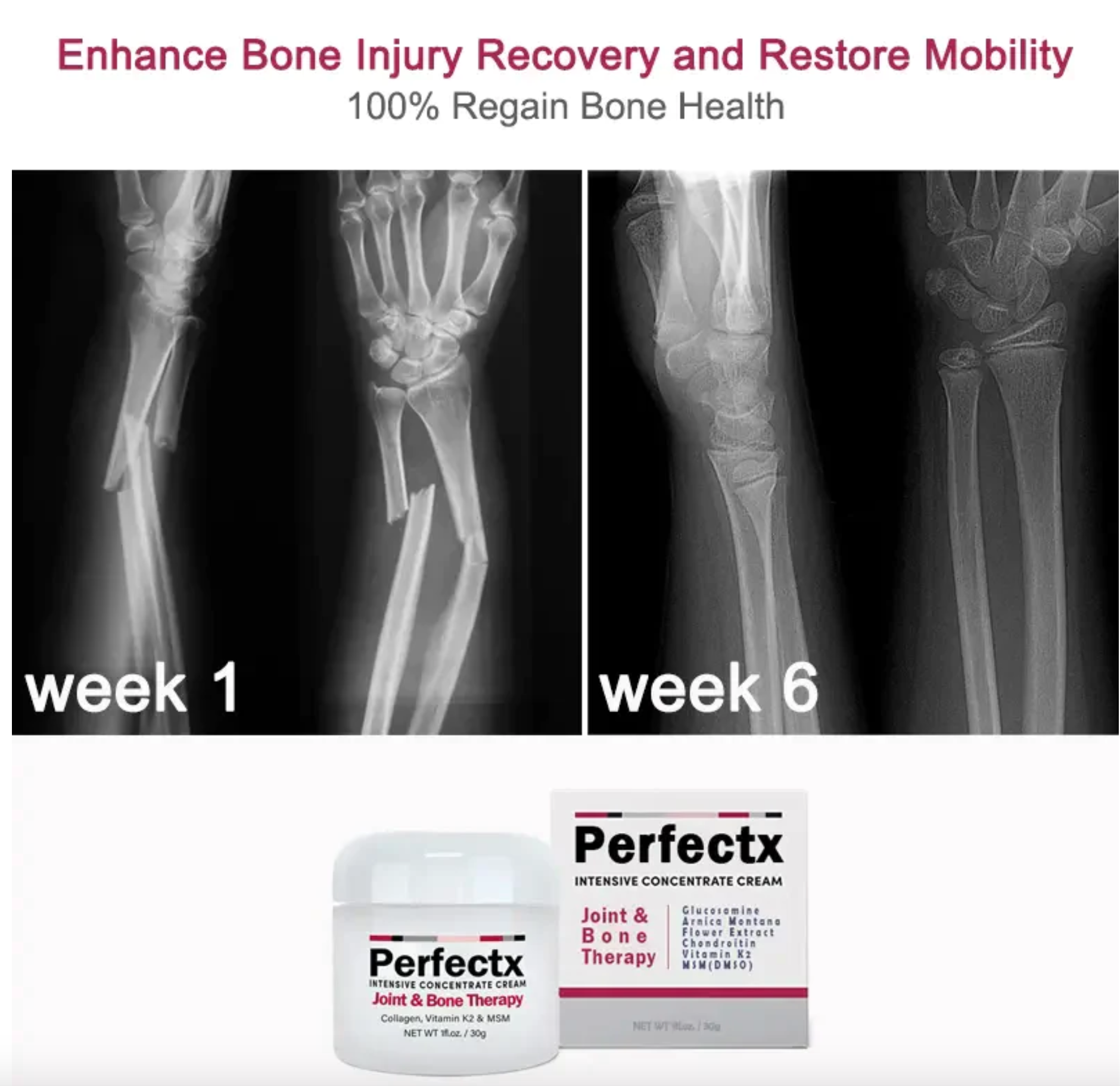 CC™ Perfectx Joint And Bone Therapy Cream - Nuskin Beauty Store