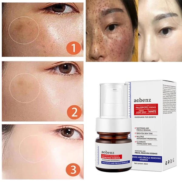 NO.1 MELASMA TREATMENT SERUM